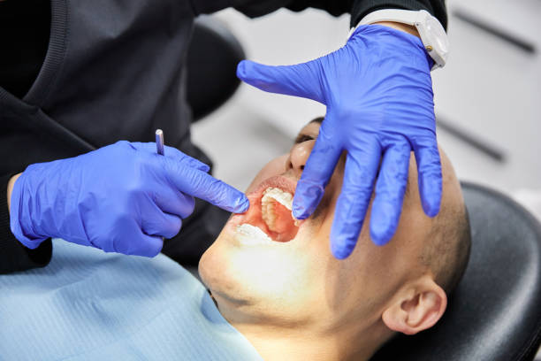 Best Dental Abscess Treatment in Rancho Viejo, TX